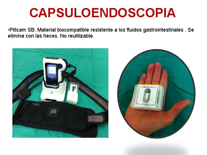 CAPSULOENDOSCOPIA • Pillcam SB. Material biocompatible resistente a los fluidos gastrointestinales. Se elimina con