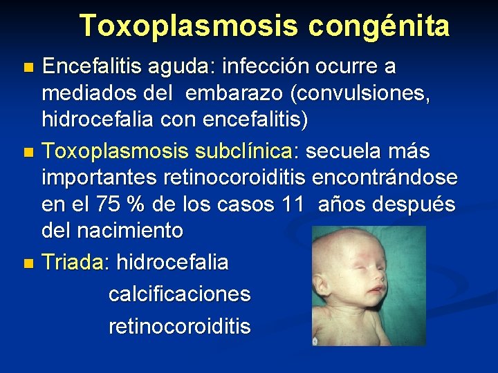 Toxoplasmosis congénita Encefalitis aguda: infección ocurre a mediados del embarazo (convulsiones, hidrocefalia con encefalitis)