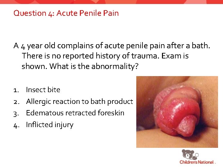 Tongue Under Foreskin