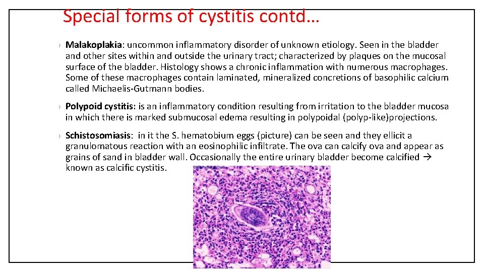 Special forms of cystitis contd… › Malakoplakia: uncommon inflammatory disorder of unknown etiology. Seen