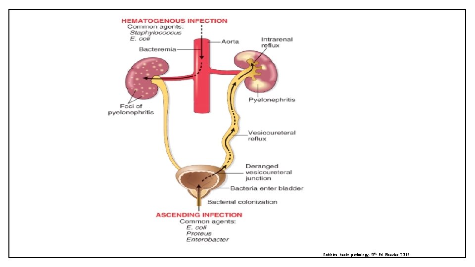 Robbins basic pathology, 9 th Ed Elsevier 2013 