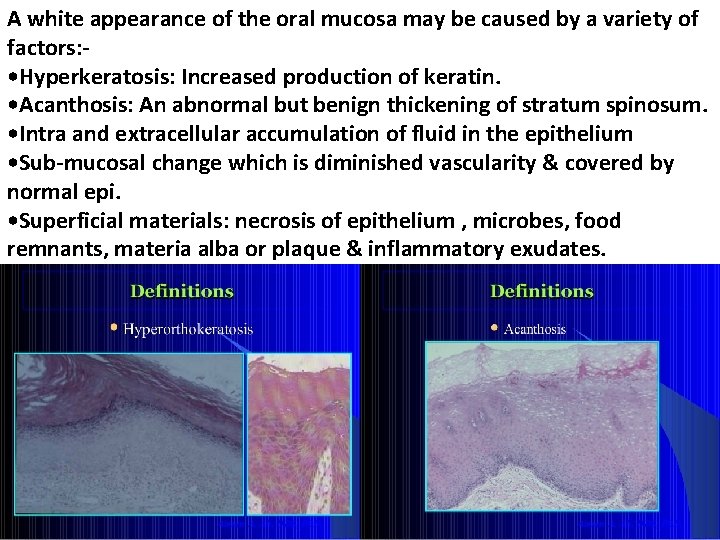 A white appearance of the oral mucosa may be caused by a variety of
