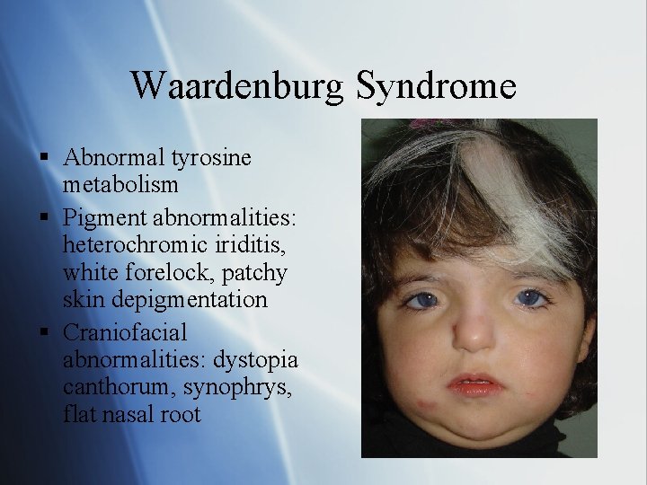Waardenburg Syndrome § Abnormal tyrosine metabolism § Pigment abnormalities: heterochromic iriditis, white forelock, patchy