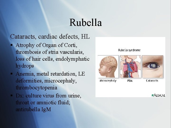 Rubella Cataracts, cardiac defects, HL § Atrophy of Organ of Corti, thrombosis of stria
