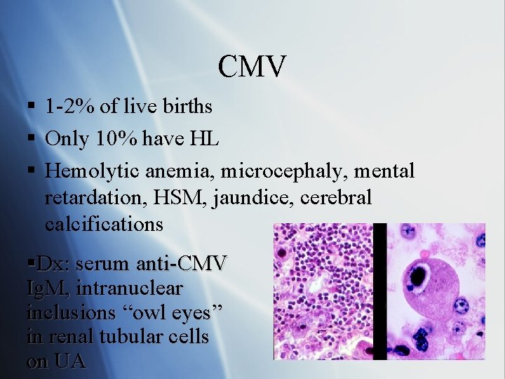 CMV § 1 -2% of live births § Only 10% have HL § Hemolytic