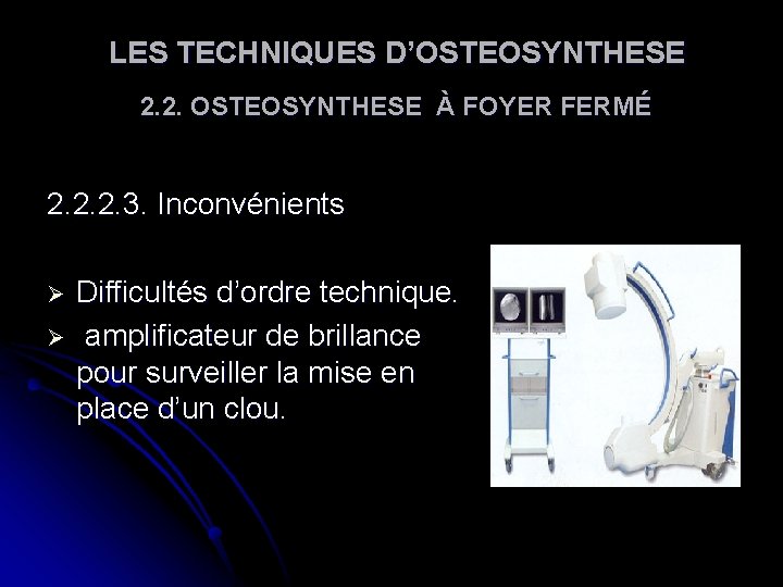 LES TECHNIQUES D’OSTEOSYNTHESE 2. 2. OSTEOSYNTHESE À FOYER FERMÉ 2. 2. 2. 3. LES TECHNIQUES D’OSTEOSYNTHESE 2. 2. OSTEOSYNTHESE À FOYER FERMÉ 2. 2. 2. 3.