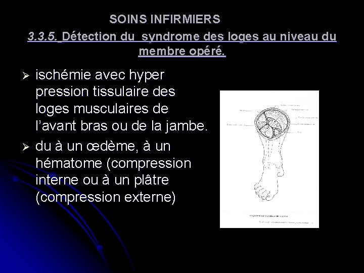 SOINS INFIRMIERS 3. 3. 5. Détection du syndrome des loges au niveau du membre SOINS INFIRMIERS 3. 3. 5. Détection du syndrome des loges au niveau du membre