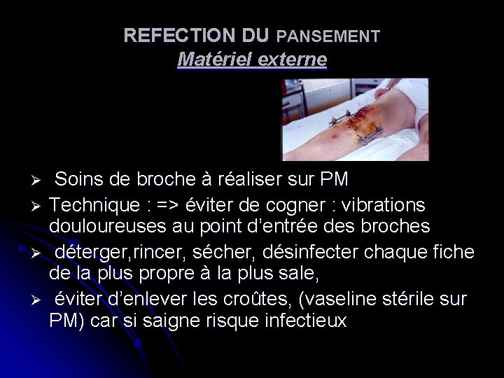REFECTION DU PANSEMENT Matériel externe Ø Ø Soins de broche à réaliser sur PM REFECTION DU PANSEMENT Matériel externe Ø Ø Soins de broche à réaliser sur PM