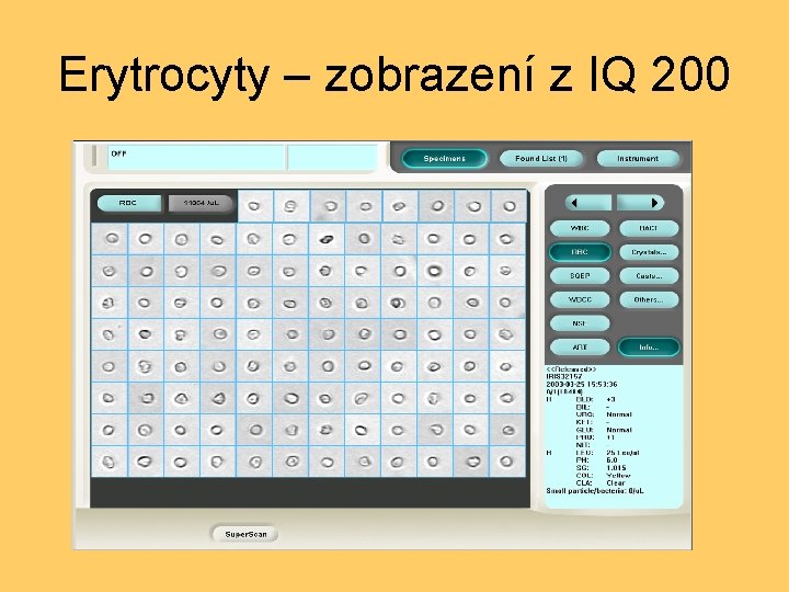 Erytrocyty – zobrazení z IQ 200 