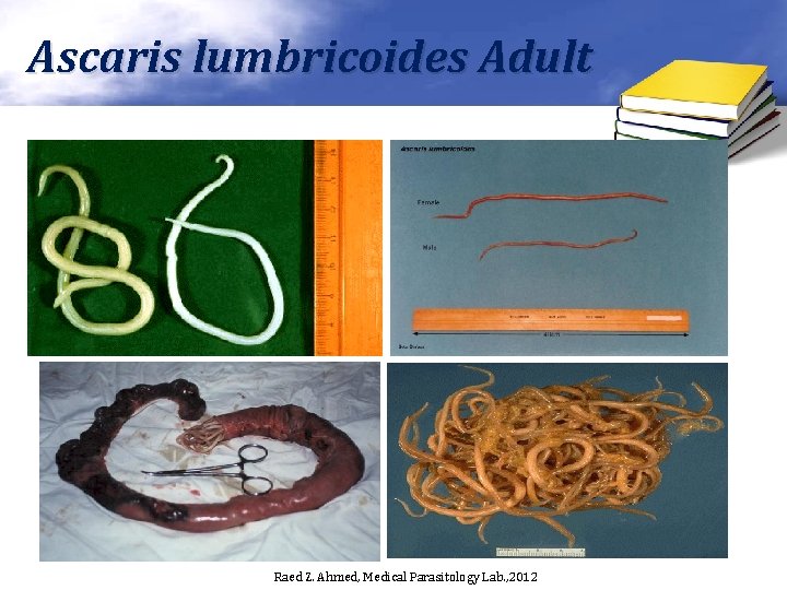 Ascaris lumbricoides Adult Raed Z. Ahmed, Medical Parasitology Lab. , 2012 Ascaris lumbricoides Adult Raed Z. Ahmed, Medical Parasitology Lab. , 2012