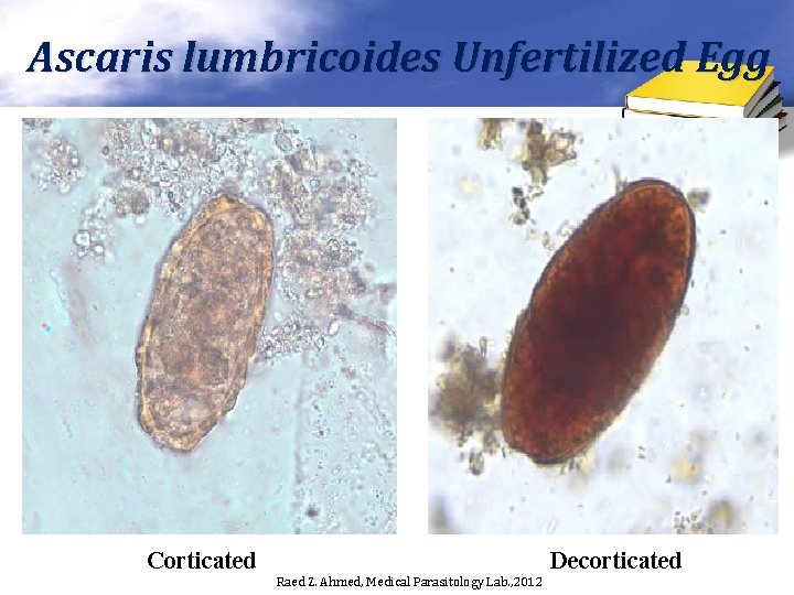 Ascaris lumbricoides Unfertilized Egg Corticated Decorticated Raed Z. Ahmed, Medical Parasitology Lab. , 2012 Ascaris lumbricoides Unfertilized Egg Corticated Decorticated Raed Z. Ahmed, Medical Parasitology Lab. , 2012