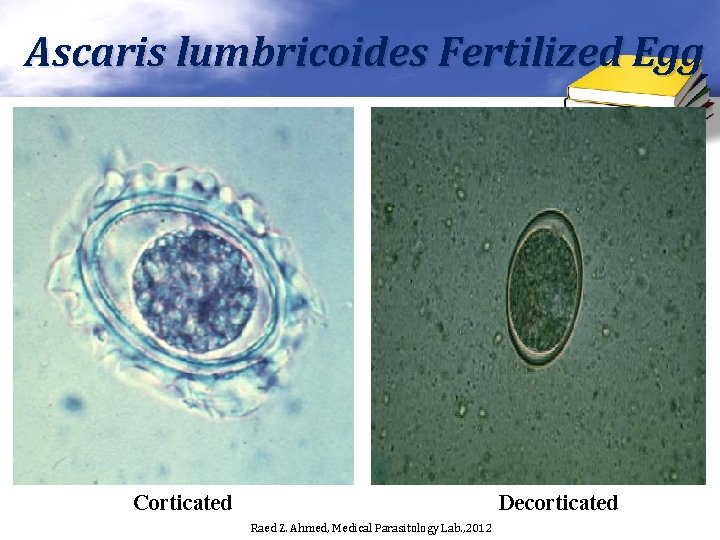 Ascaris lumbricoides Fertilized Egg Corticated Decorticated Raed Z. Ahmed, Medical Parasitology Lab. , 2012 Ascaris lumbricoides Fertilized Egg Corticated Decorticated Raed Z. Ahmed, Medical Parasitology Lab. , 2012
