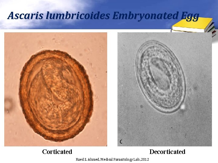 Ascaris lumbricoides Embryonated Egg Corticated Decorticated Raed Z. Ahmed, Medical Parasitology Lab. , 2012 Ascaris lumbricoides Embryonated Egg Corticated Decorticated Raed Z. Ahmed, Medical Parasitology Lab. , 2012