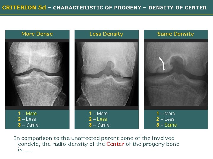 CRITERION 5 d – CHARACTERISTIC OF PROGENY – DENSITY OF CENTER More Dense Less