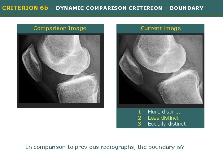 CRITERION 6 b – DYNAMIC COMPARISON CRITERION – BOUNDARY Comparison Image Current image Need