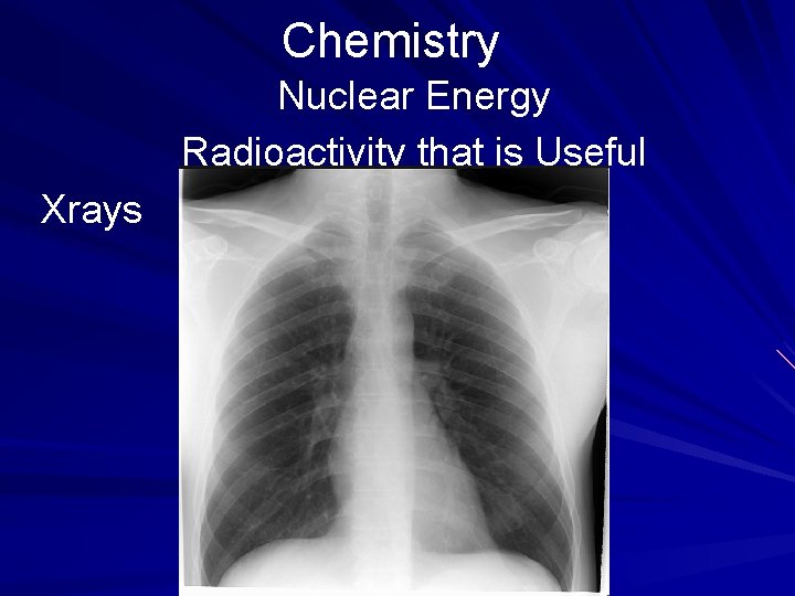 Chemistry Nuclear Energy Radioactivity that is Useful Xrays 