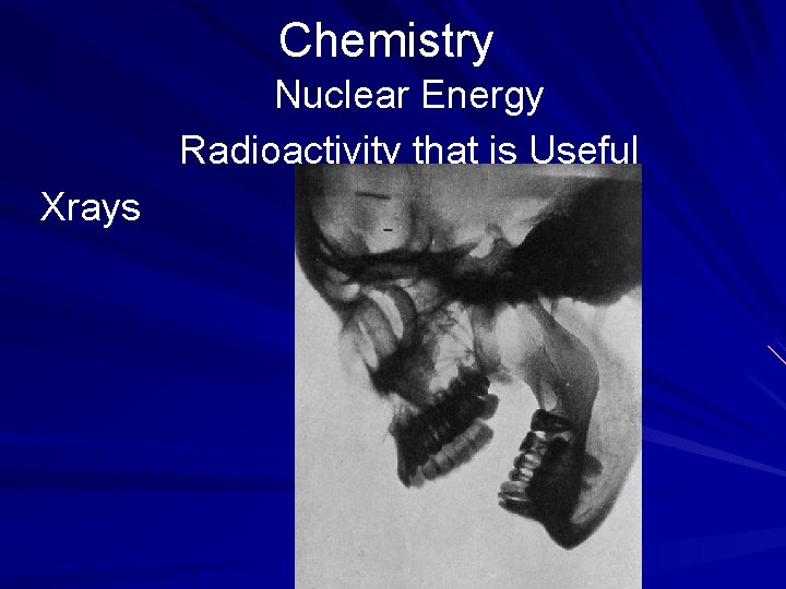 Chemistry Nuclear Energy Radioactivity that is Useful Xrays 