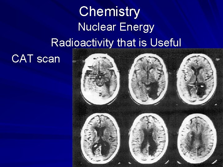 Chemistry Nuclear Energy Radioactivity that is Useful CAT scan 