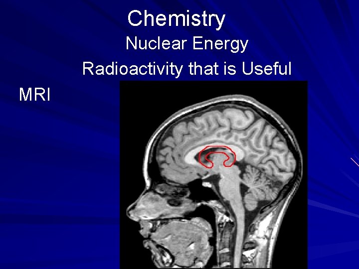 Chemistry Nuclear Energy Radioactivity that is Useful MRI 