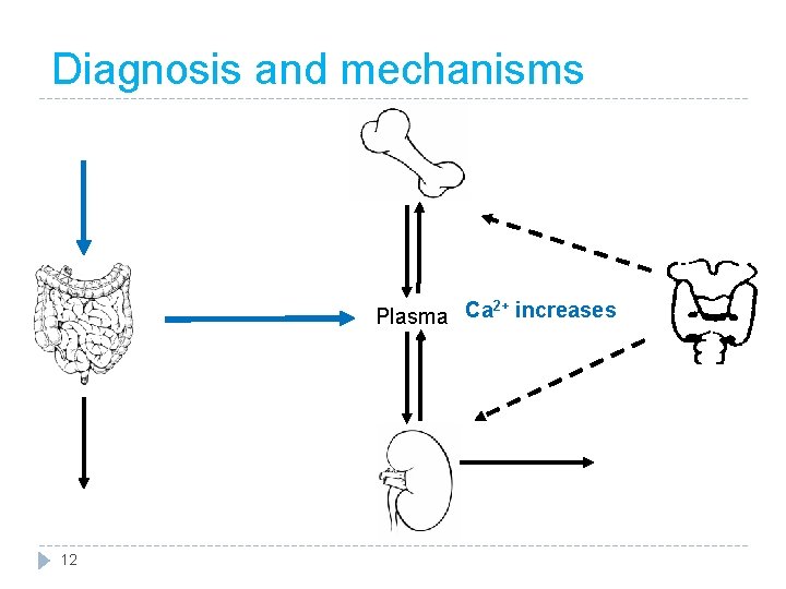 Diagnosis and mechanisms 2+ Plasma Ca increases 12 