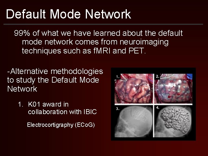 Default Mode Network 99% of what we have learned about the default mode network