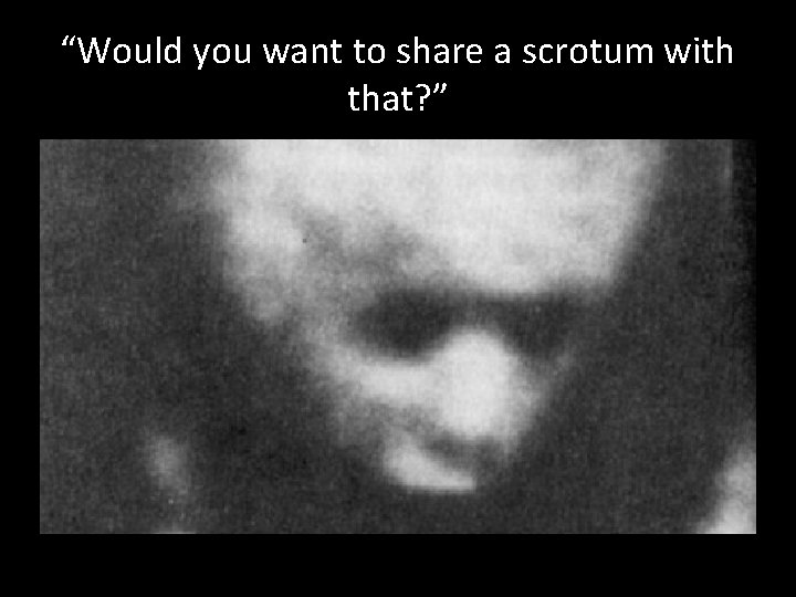 “Would you want to share a scrotum with that? ” 