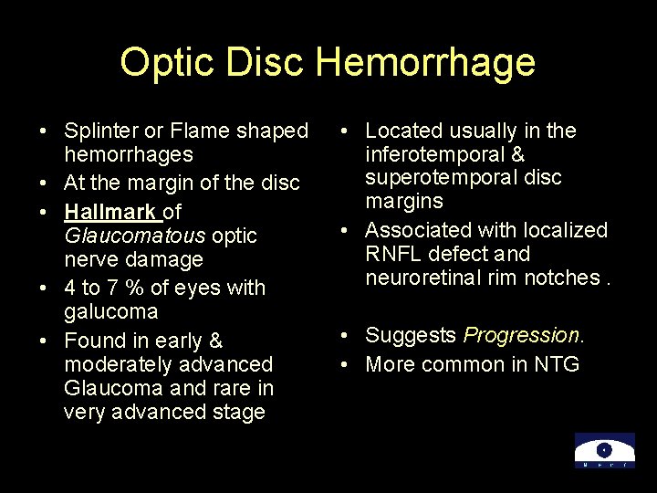 Optic Disc Hemorrhage • Splinter or Flame shaped hemorrhages • At the margin of