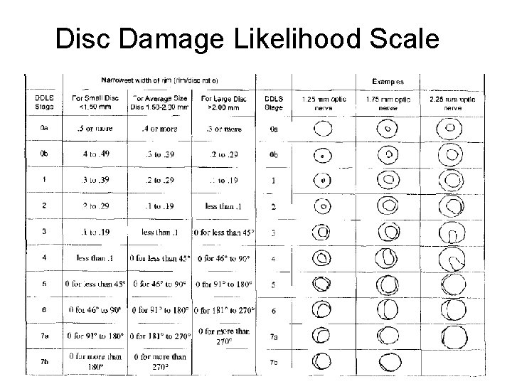 Disc Damage Likelihood Scale 