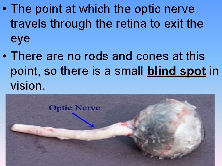  • The point at which the optic nerve travels through the retina to