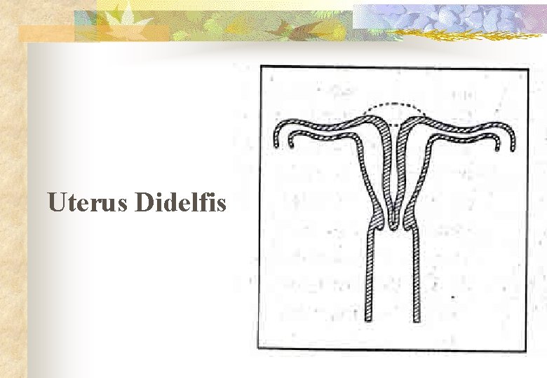 Uterus Didelfis 