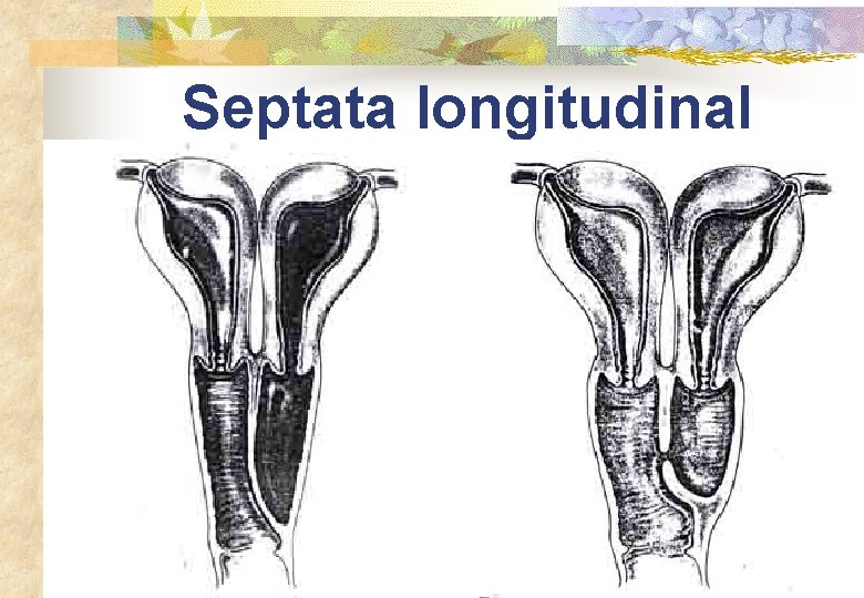 Septata longitudinal 