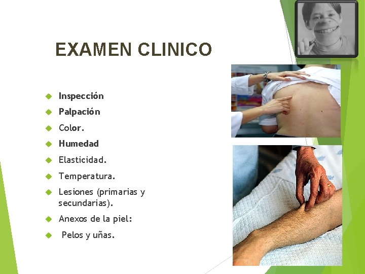 EXAMEN CLINICO Inspección Palpación Color. Humedad Elasticidad. Temperatura. Lesiones (primarias y secundarias). Anexos de