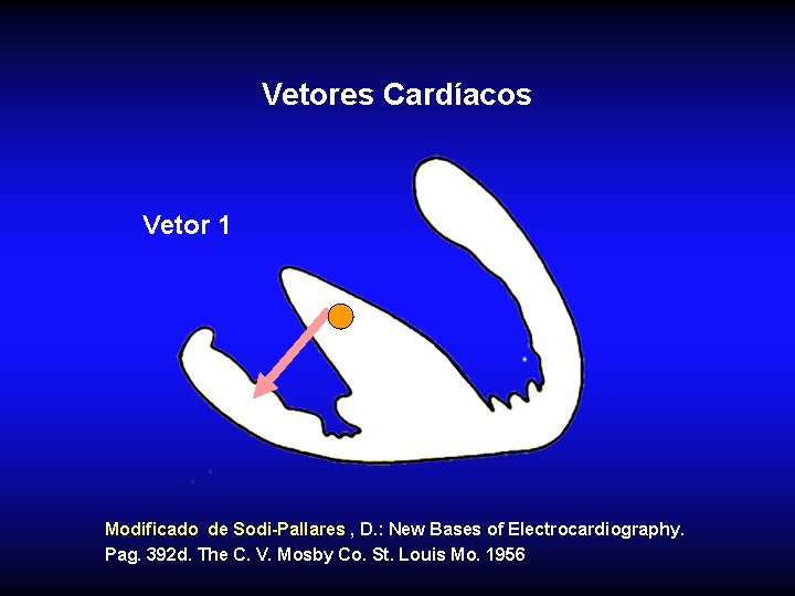 Vetores Cardíacos Vetor 1 Modificado de Sodi-Pallares , D. : New Bases of Electrocardiography.