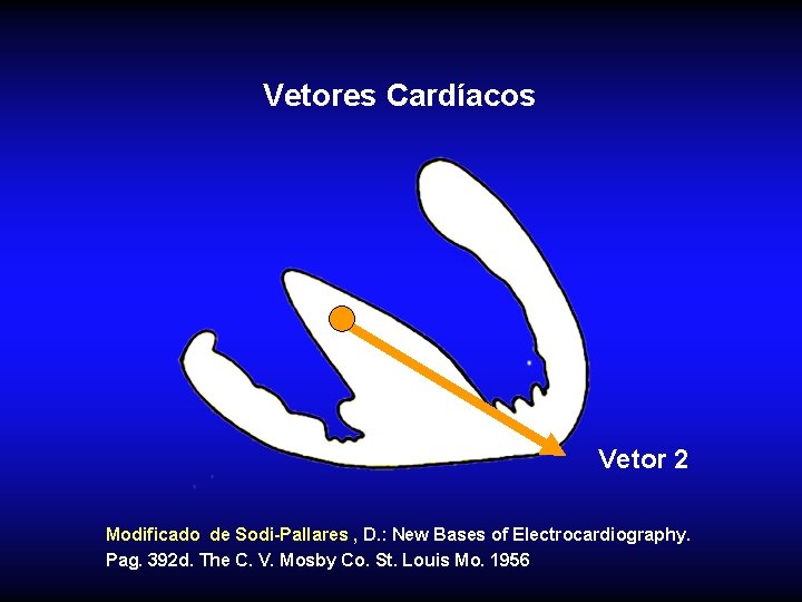 Vetores Cardíacos Vetor 2 Modificado de Sodi-Pallares , D. : New Bases of Electrocardiography.