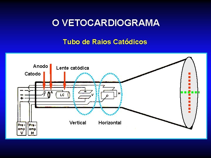 O VETOCARDIOGRAMA Tubo de Raios Catódicos Anodo Lente catódica Catodo Vertical Horizontal 