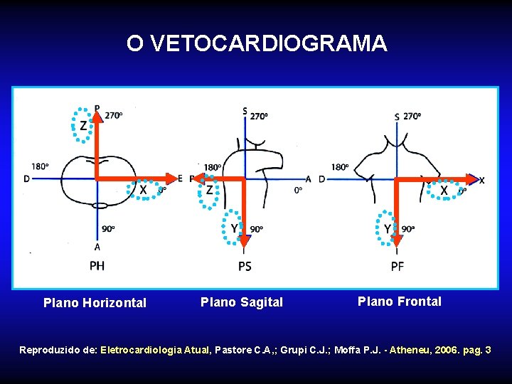 O VETOCARDIOGRAMA Plano Horizontal Plano Sagital Plano Frontal Reproduzido de: Eletrocardiologia Atual, Pastore C.