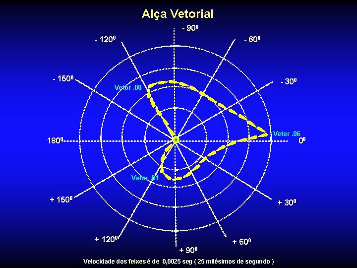 Alça Vetorial - 900 - 1200 - 600 - 1500 - 300 Vetor. 08