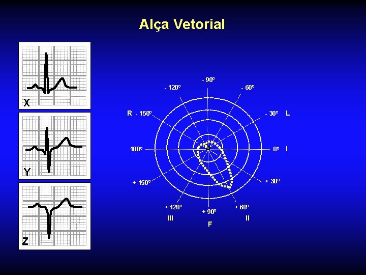 Alça Vetorial - 900 - 1200 - 600 X R - 1500 - 300