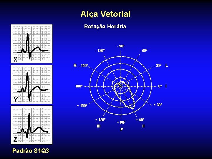 Alça Vetorial Rotação Horária - 900 - 1200 - 600 X R - 1500