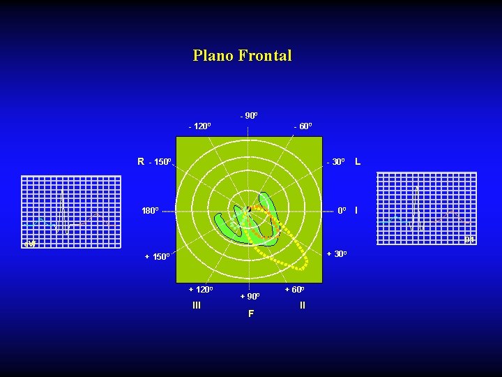 Plano Frontal - 900 - 1200 - 600 R - 1500 - 300 1800