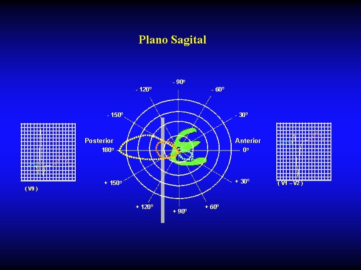 Plano Sagital - 900 - 1200 - 600 - 1500 - 300 Anterior Posterior