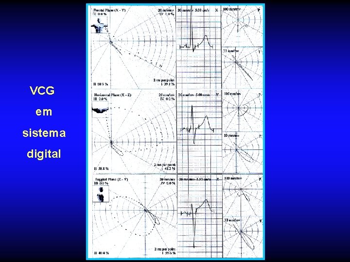 VCG em sistema digital 