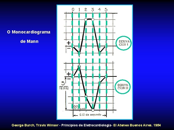 O Monocardiograma de Mann George Burch, Travis Winsor - Principios de Eletrocardiologia- El Ateneo