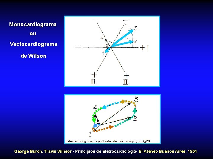 Monocardiograma ou Vectocardiograma de Wilson George Burch, Travis Winsor - Principios de Eletrocardiologia- El