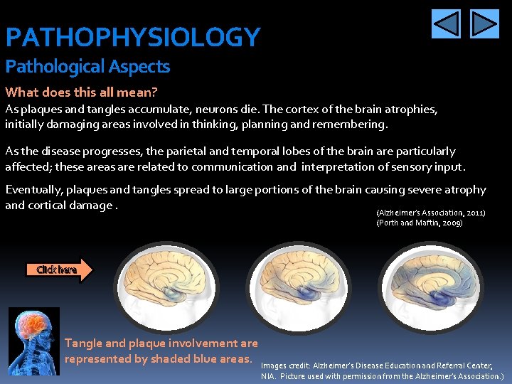 PATHOPHYSIOLOGY Pathological Aspects What does this all mean? As plaques and tangles accumulate, neurons