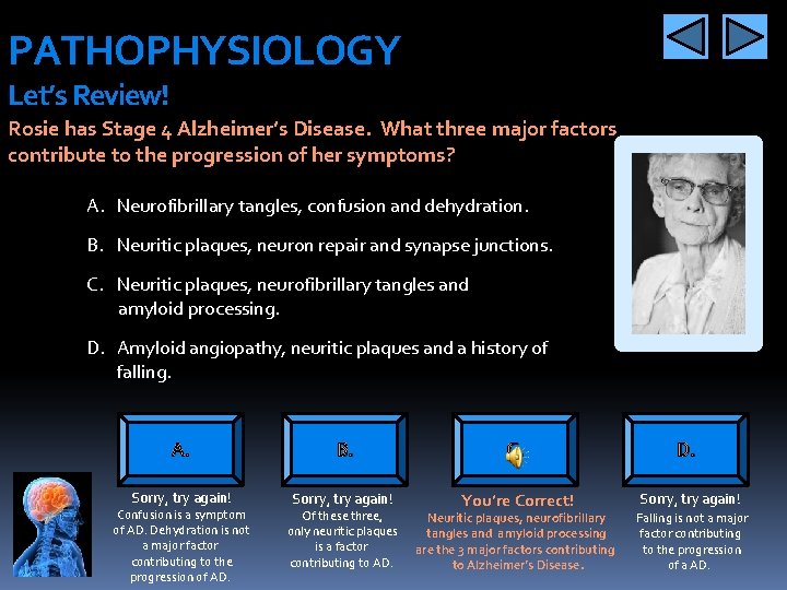 PATHOPHYSIOLOGY Let’s Review! Rosie has Stage 4 Alzheimer’s Disease. What three major factors contribute
