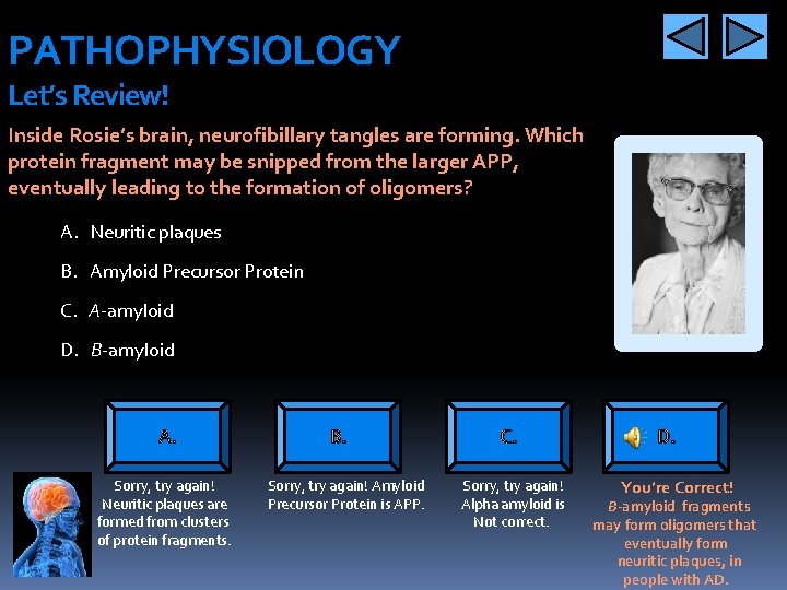 PATHOPHYSIOLOGY Let’s Review! Inside Rosie’s brain, neurofibillary tangles are forming. Which protein fragment may