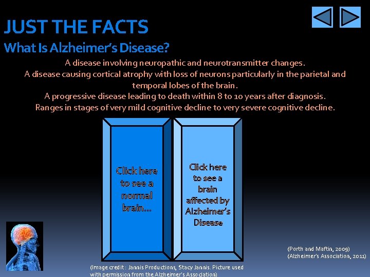 JUST THE FACTS What Is Alzheimer’s Disease? A disease involving neuropathic and neurotransmitter changes.