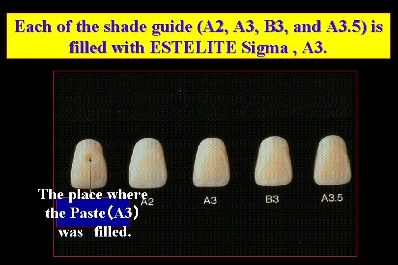 Each of the shade guide (A 2, A 3, B 3, and A 3.