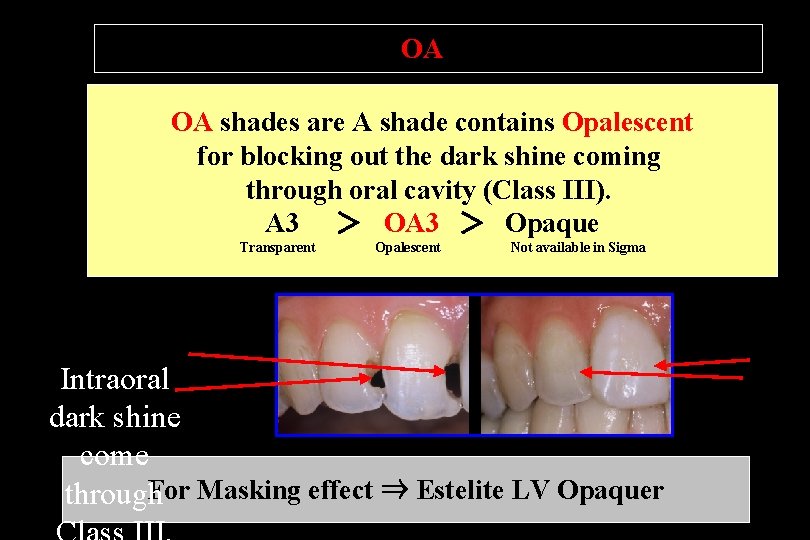 What is OA Shades ? OA shades are A shade contains Opalescent for blocking